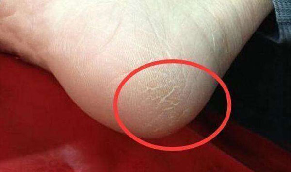 �ź��������ʲôԭ�� �ź�����ѱ�����������